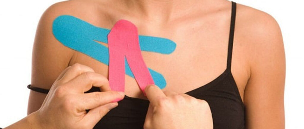 kinesio-taping